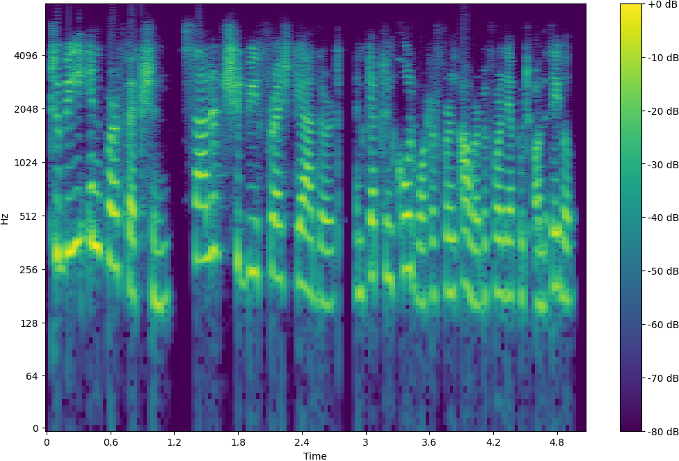Spectrogram